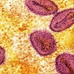 Virus Hanta di Bandung Barat, Dinkes Langsung Bergerak