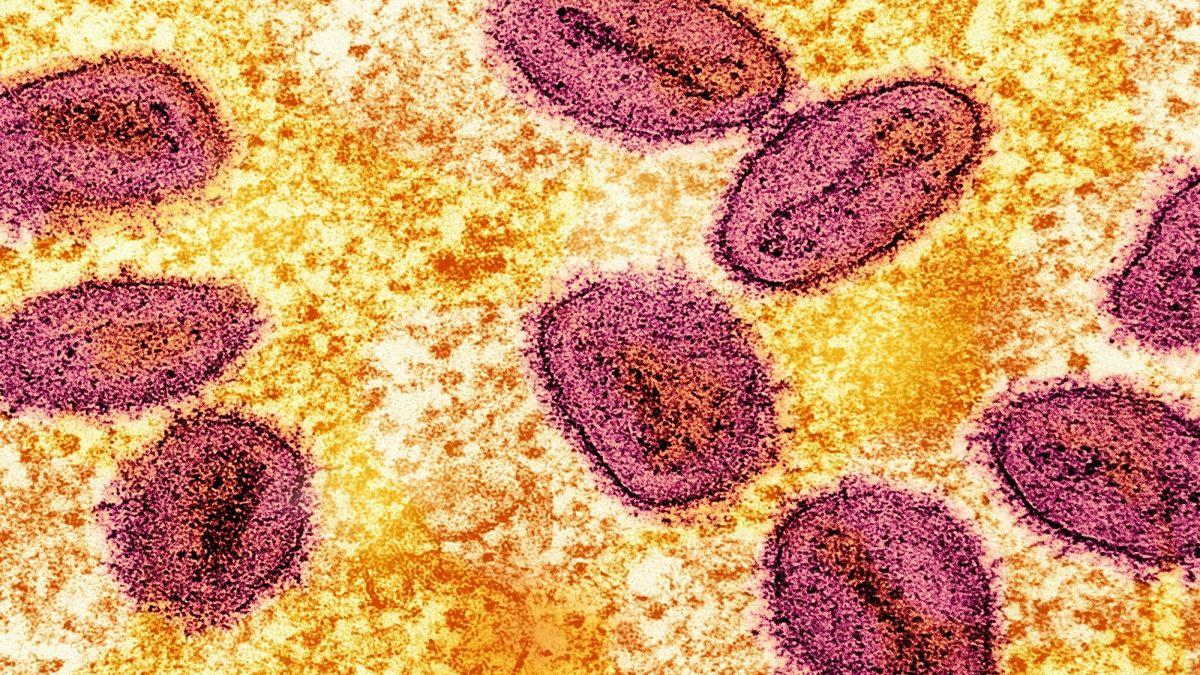 Virus Hanta Terdeteksi di Bandung Barat, Dinkes Langsung Bergerak Cepat! Virus Hanta Terdeteksi di Bandung Barat, Dinkes Langsung Bergerak Cepat!