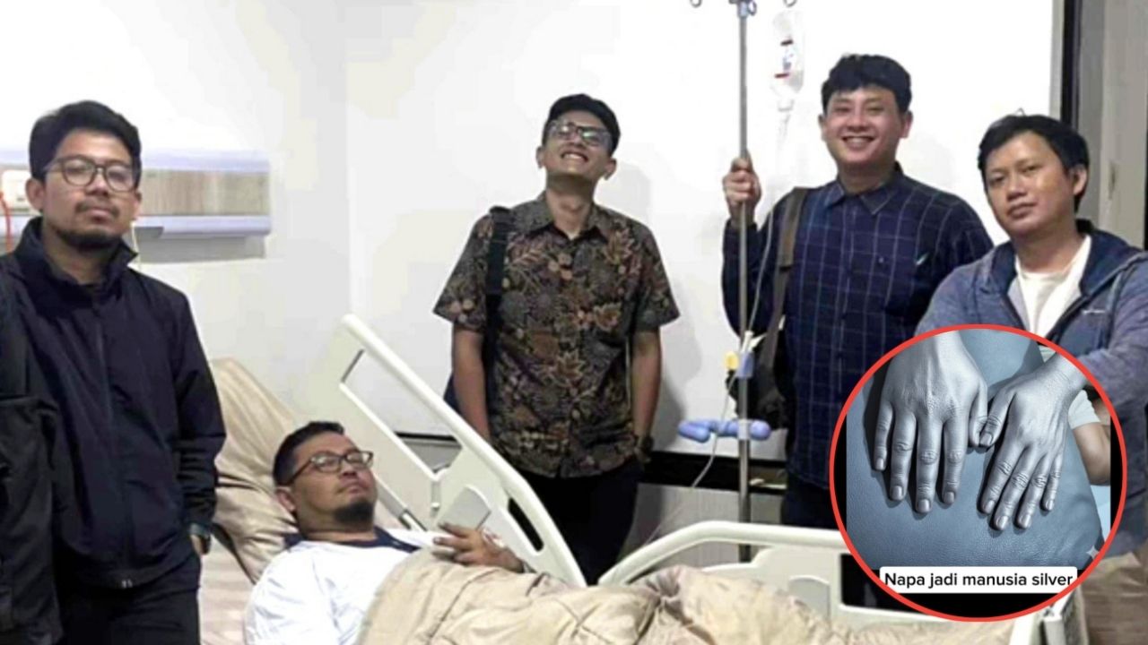 Teman Kecelakaan Hingga Patah Tangan, Cara Support Cowok-Cowok Ini Malah Di Luar Nalar dan Bikin Ngakak Teman Kecelakaan Hingga Patah Tangan, Cara Support Cowok-Cowok Ini Malah Di Luar Nalar dan Bikin Ngakak