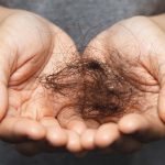 Gen Z Lebih Rentan Alami Rambut Rontok Dibanding Milenial, Berikut Penjelasannya!