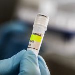 Menkes Pastikan Kasus Hantavirus di DKI Jakarta Terkendali, Kontak Erat Dipantau 14 Hari