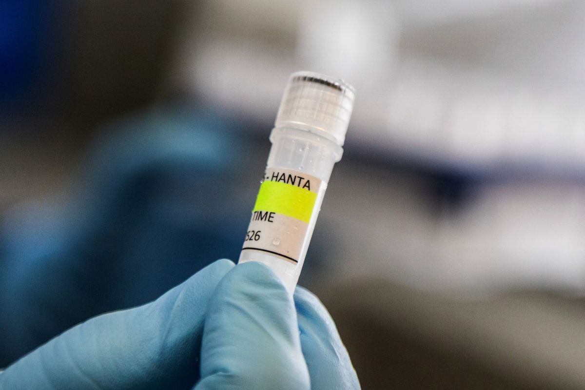 Menkes Pastikan Kasus Hantavirus di DKI Jakarta Terkendali, Kontak Erat Dipantau 14 Hari Menkes Pastikan Kasus Hantavirus di DKI Jakarta Terkendali, Kontak Erat Dipantau 14 Hari